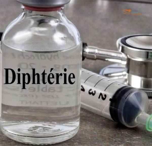 Diphtérie : Bakel a enregistré le décès d’un enfant sur fond de pénurie d’antitoxine diphtérique