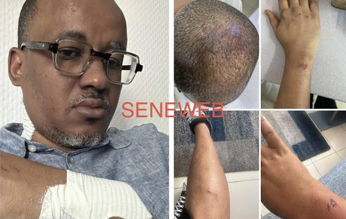 Tribunal de Pikine-Guédiawaye : Oumar Sow porte plainte avec constitution de partie civile pour « actes de torture »