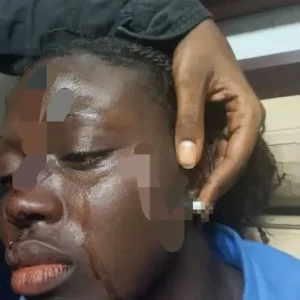 Ziguinchor : une élève grièvement agressée par ses camarades de classe