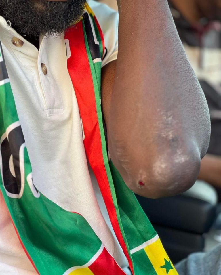 Manifestation pacifique : Thierno Bocoum blessé à la Place de la Nation