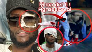 (Vidéo) – Délégué Amar raconte le filme de son agress!on : « Pistølet la guéné… »