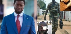 «J’ai perdu l’œil droit» : un militaire radié écrit à Diomaye Faye