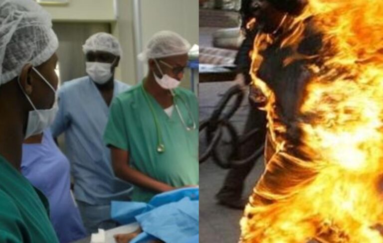 Ziguinchor : Des nouvelles de Khady, la fillette brûlée par son père