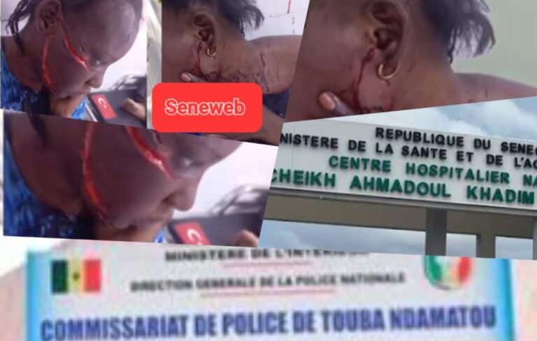 H0rreur à Touba : une infirmière d’état l@céréale visage de sa coépouse