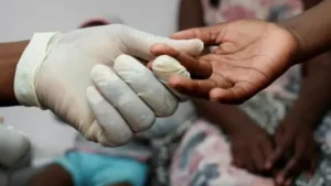 Lutte contre le VIH : « Les patients ont disparu »
